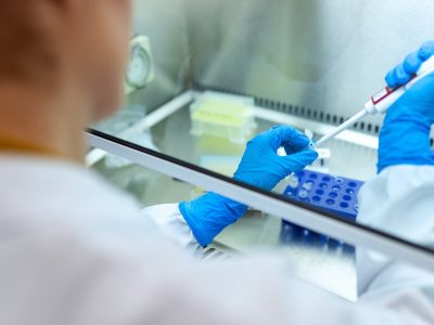 Prvých 100-tisíc testov, ktoré Slovensku darovala Nadácia ESET, je pripravených na odovzdanie